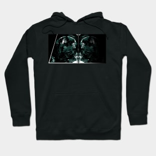 Mirror Game Collage Hoodie